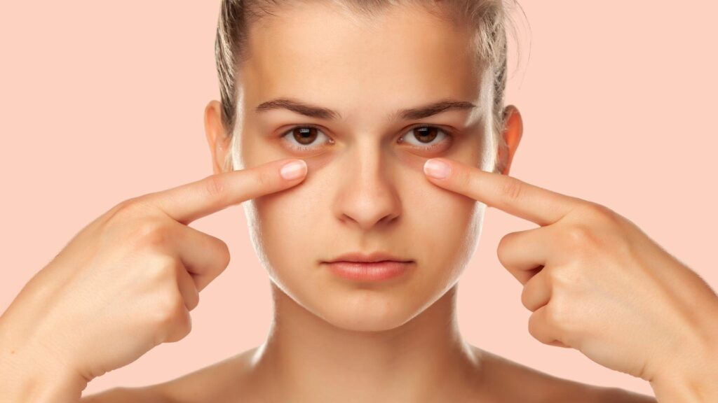 Dark Circles Removal