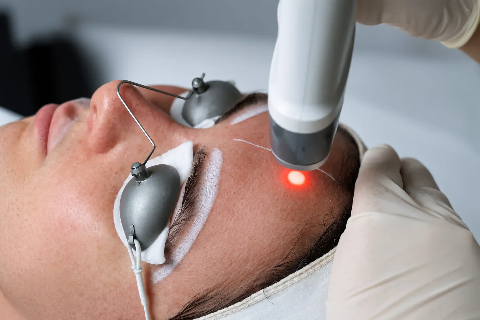 Laser treatments