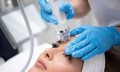 RF Microneedling
